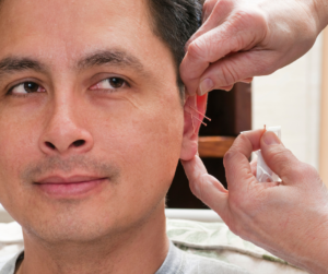 How Ear Acupuncture Helps the Body Heal from Stress and Trauma