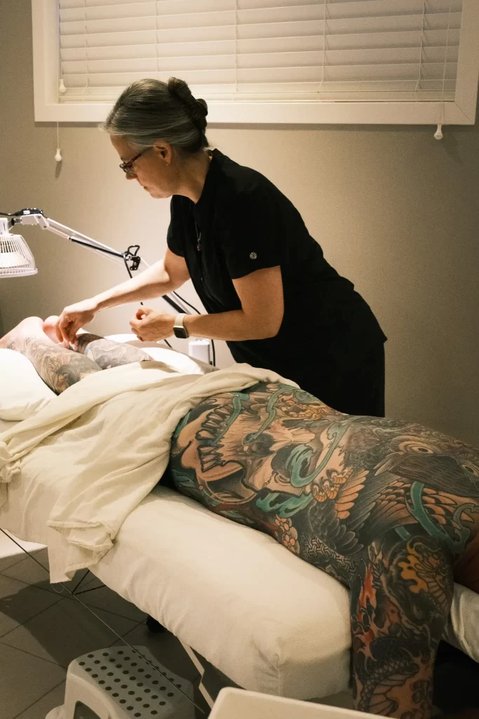 Vanessa Ebertz doing acupuncture on PTDS patient at Blue Frog Wellness in Calgary.